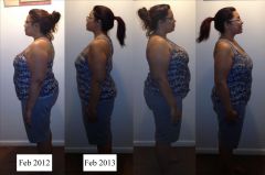 Before And after 1
