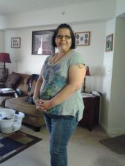 1 month after surgery