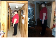 Morning of Surgery and 9/14/13 7 months post op - same clothes different look