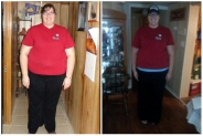 Morning of Surgery and 9/14/13 7 months post op - same clothes different look