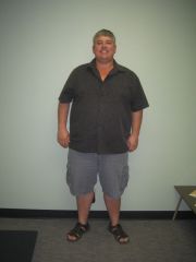 David Pre Op 324 lb's