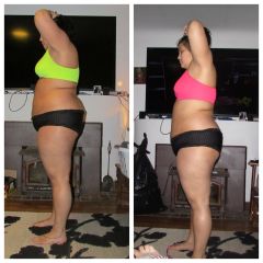 One month post op side