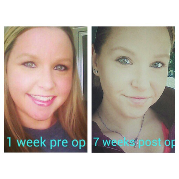 Progress!