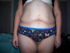 still not great front view now