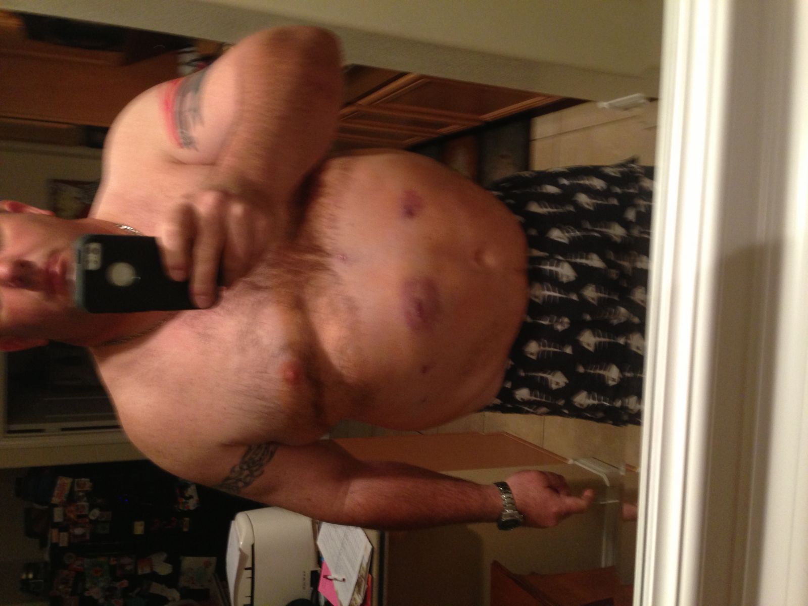 Gregwithlapband