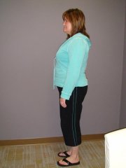 Sideview of "Before" Pic at Doctor's Office