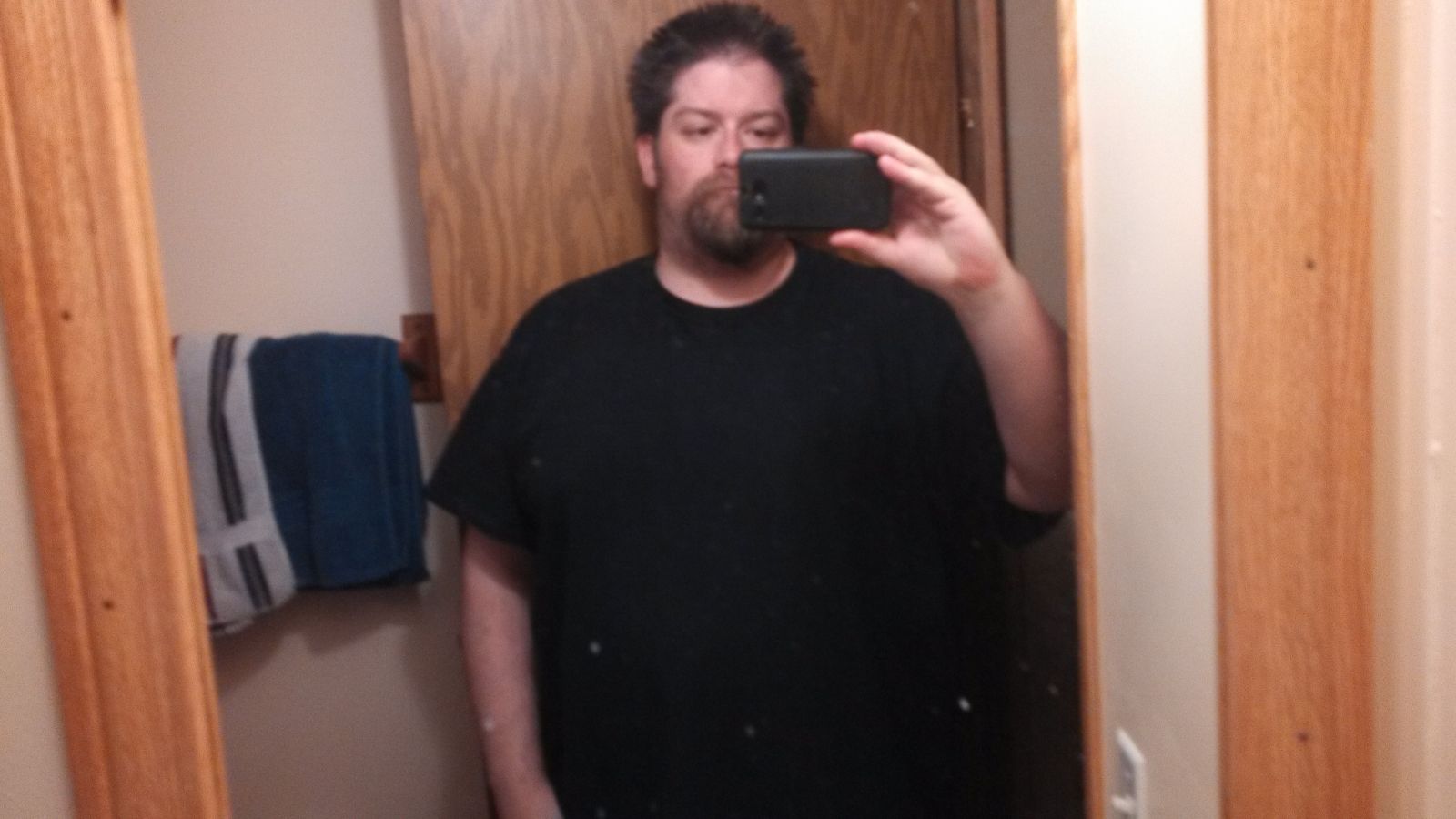 Pre-op pics.