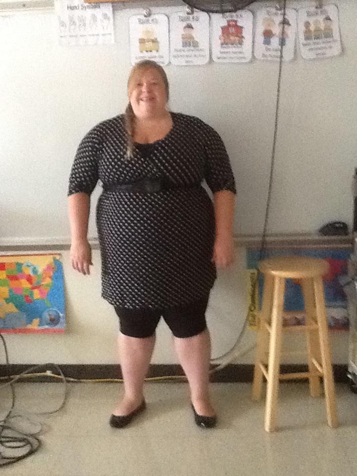 Before Surgery