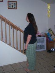Day of surg! March 2nd, 09