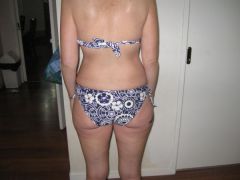 back