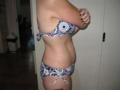 right side