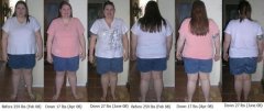 Front and back view