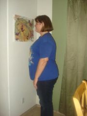 9 27 09 before surgery