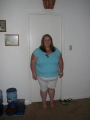14 days Pre-op