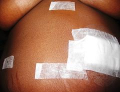 My Battle Scars