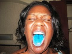 After the blue dye test!