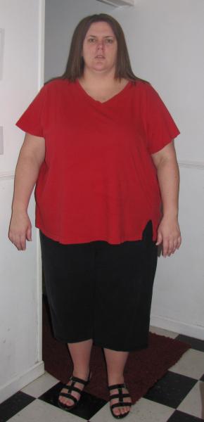 The day of surgery and after pics