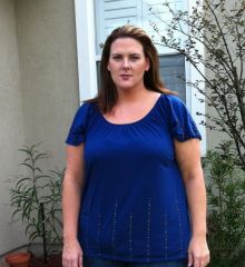 4 month post op
