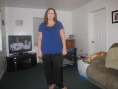 4 month post op