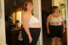 Before surgery 4/11