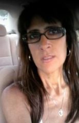 7 24 2010 me--take a look at my neck and the bones! I have deflated small breasts now literally they lie flat against my body and a bra only pushes up skin!
