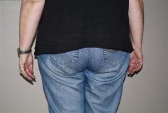BEFORE up close big butt view (courtesy of my husband!)
