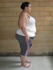 VSG Pic
Taken a few days before Surgery