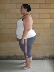 VSG Pic
Taken a few days before Surgery