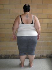 VSG Pic
Taken a few days before Surgery