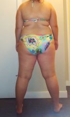 BeforeSurgeryBack