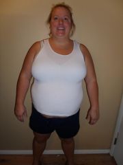 Before surgery