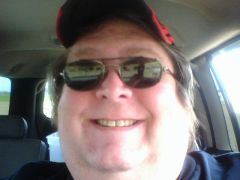 Before Surgery (face shot)