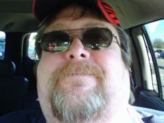 Before Surgery (face shot)