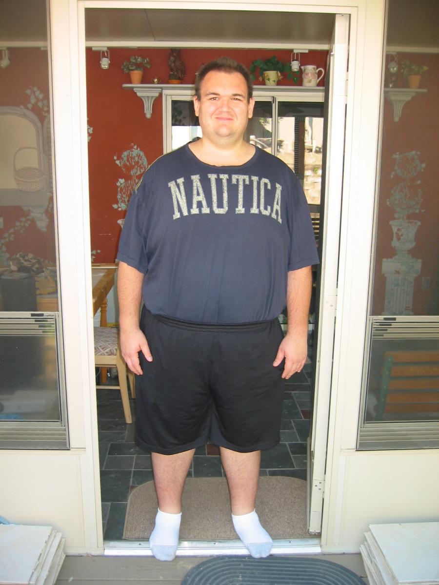 Before Surgery
