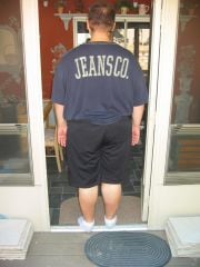 Before Surgery July 2010
