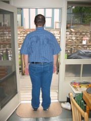 Three Months After Surgery