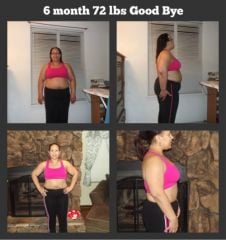 6mon before And after
