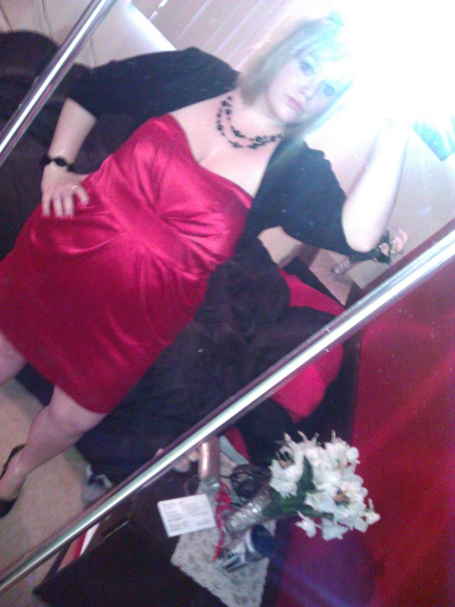 Life before surgery <3