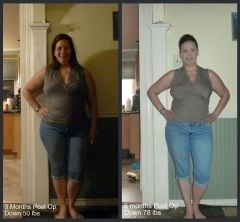 Before And After 3&6mo