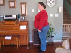 BEFORE- 3 months pre op