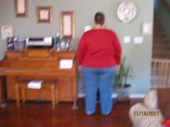 BEFORE- 3 months pre op