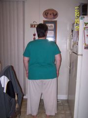 Backside before