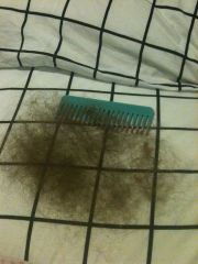 hair loss (4 months)