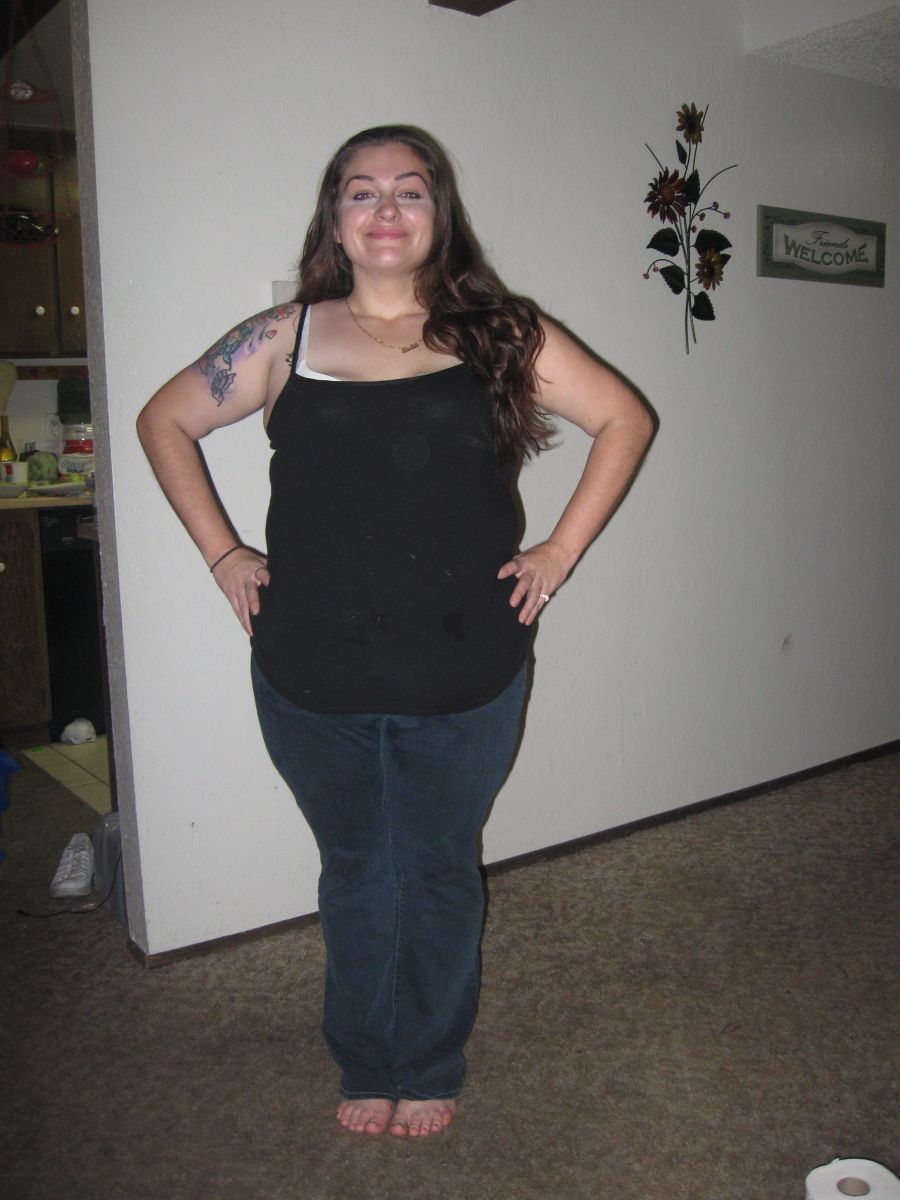 1 month post-op