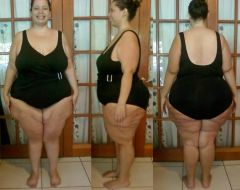 2 month post