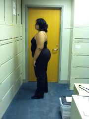 Before surgery 5