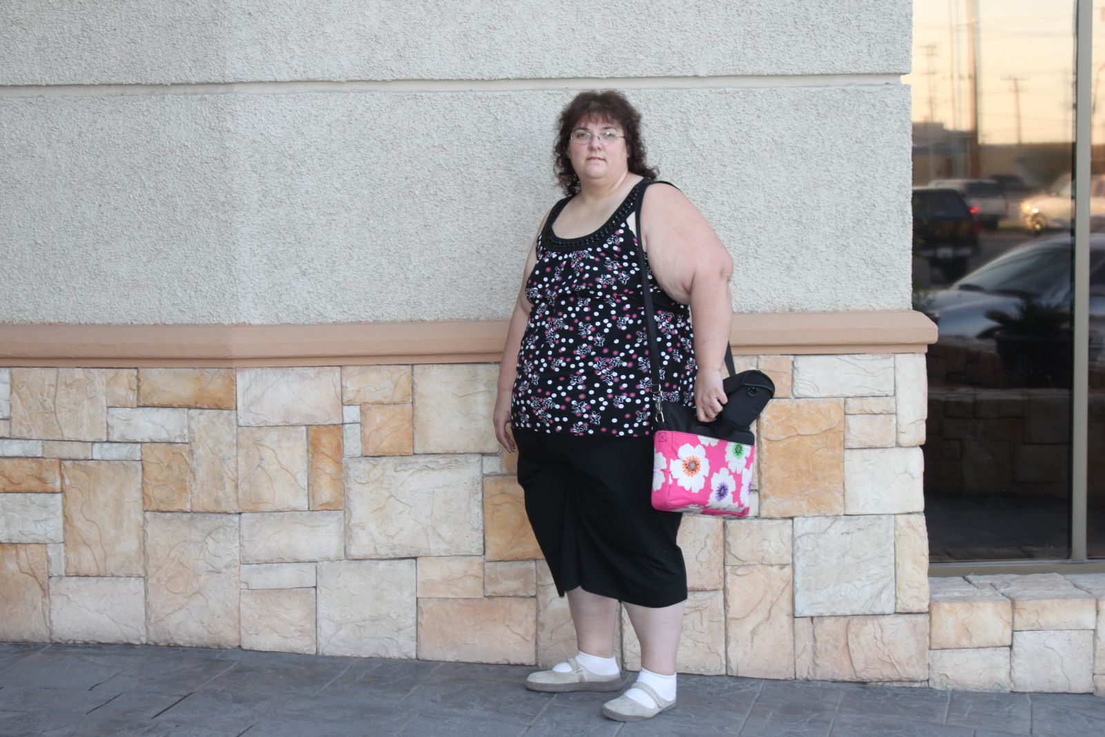 My Surgery before/During Pix