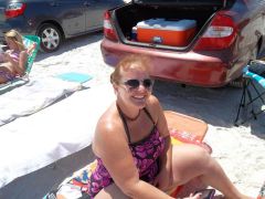 4/15/2012 - 12 weeks post-op