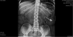 xRAY3