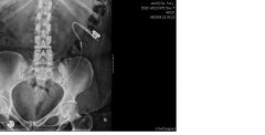 xray2